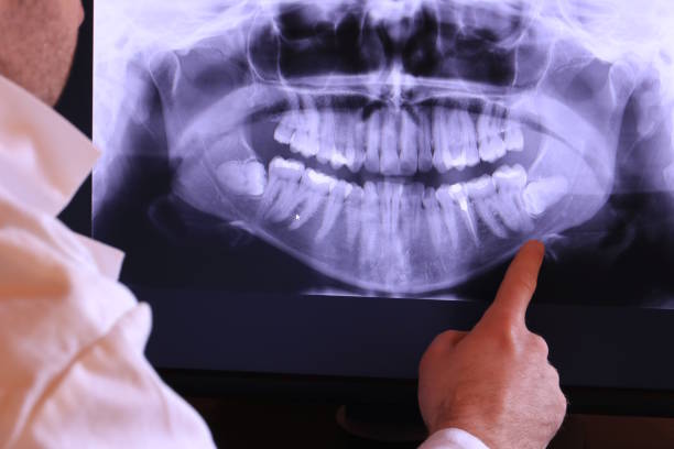 Best Emergency TMJ Treatment in Brooklyn, OH