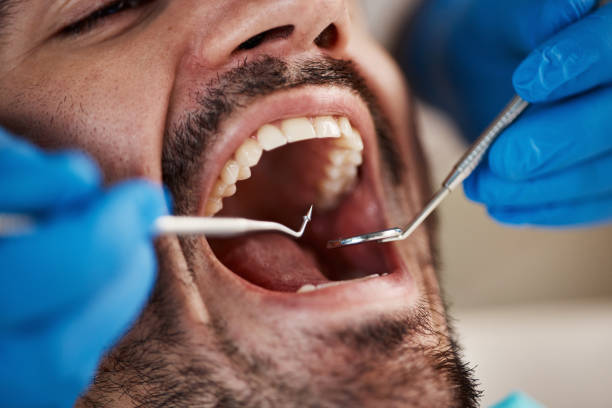 Best Urgent Care for Lost Fillings or Crowns in Brooklyn, OH